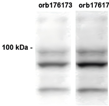 CLAC-P (NC2-1 region) Antibody