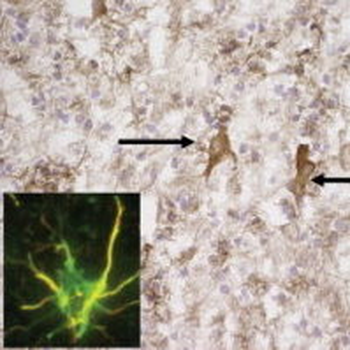 PTEN-induced kinase/PINK1 Antibody