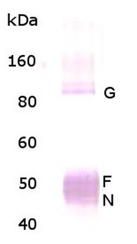 Respiratory Syncytial Virus (RSV) Antibody