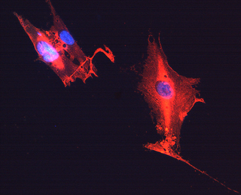 GFAP Antibody