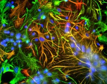 GFAP Antibody