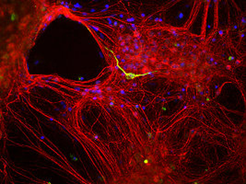 Neurofilament alpha-internexin/NF66 Antibody