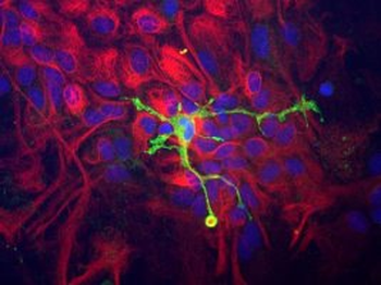 Coronin 1a/p57 Antibody
