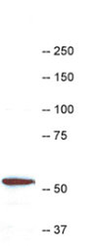 Coronin 1a/p57 Antibody