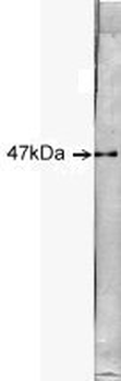 Neuron Specific Enolase (NSE)/ENO2 Antibody