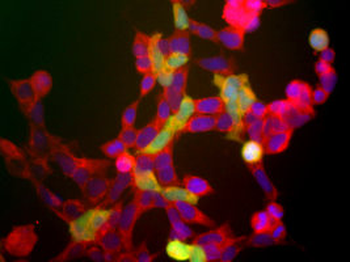 Neuron Specific Enolase (NSE)/ENO2 Antibody