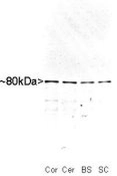 MARCKS (Myristoylated Alanine Rich C Kinase Substrate) Antibody