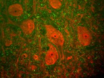 Neurofilament NF-H, phosphylated Antibody