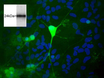 PGP9.5/UCHL1 Antibody