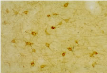 5HT (Serotonin) 2A Receptor, 5HT2A R Antibody