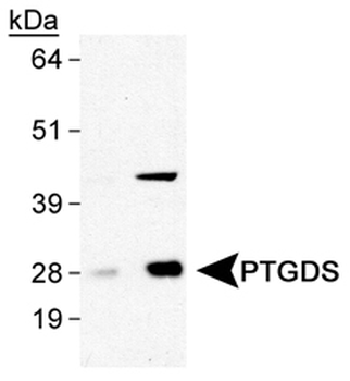 PTGDS Antibody