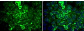 SSEA3 Antibody