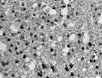 Factor Inhibiting HIF-1/FIH Antibody