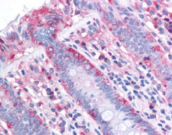 ChREBP Antibody