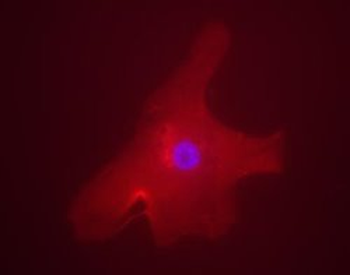 ChREBP Antibody