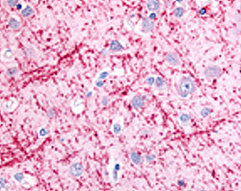 LC3 Antibody