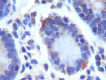 GPR49 Antibody