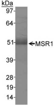 Macrophage Scavenger Receptor I/CD204 Antibody