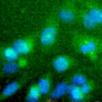 Macrophage Scavenger Receptor I/CD204 Antibody