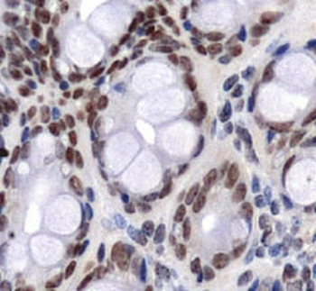 GLUT1 Antibody