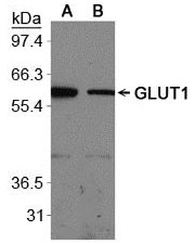 GLUT1 Antibody