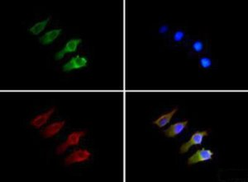 Semaphorin 3B Antibody