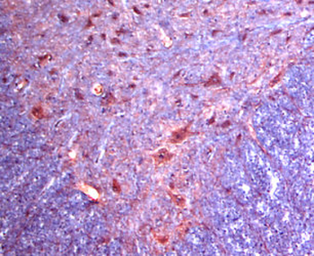 Alpha 2c peptide