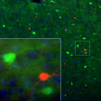 Calretinin Antibody
