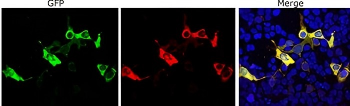 Cas9 from Staphylococcus aureus Antibody