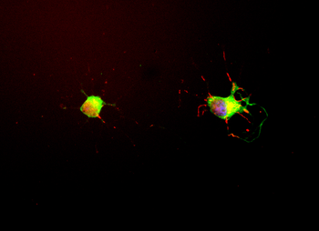 Tau (MAPT) Antibody