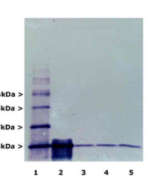 Ubiquitin Antibody
