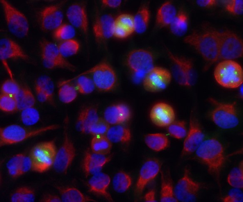 Aurora A/B Antibody