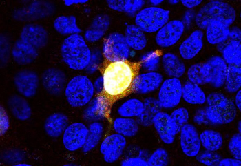 Cas9 from Streptococcus pyogenes Antibody