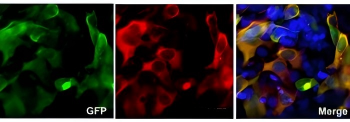 Cas9 from Staphylococcus aureus Antibody