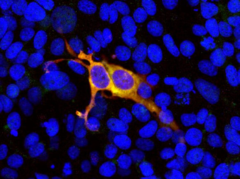 Cas9 from S. pyogenes Antibody