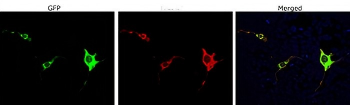 Cas9 from Staphylococcus aureus Antibody