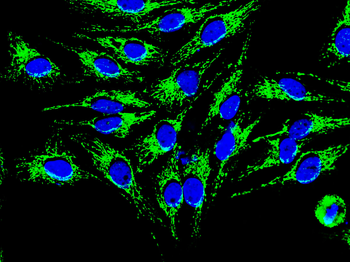 HSP60 Antibody