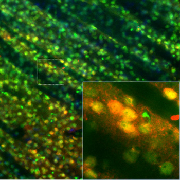 Calbindin Antibody