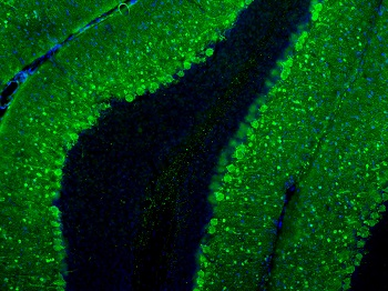 Parvalbumin Antibody