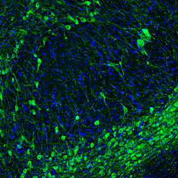 Tyrosine Hydroxylase Antibody
