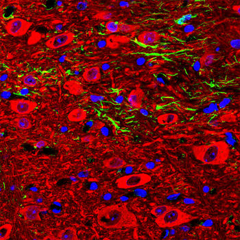 Neuron Specific Enolase (NSE) Antibody