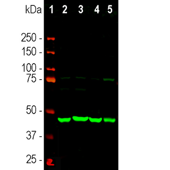 Neuron Specific Enolase (NSE) Antibody