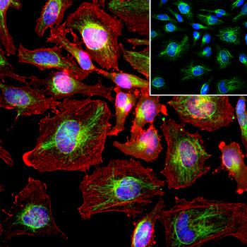 Vimentin Antibody