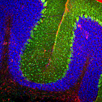 Glial Fibrillary Acidic Protein (GFAP) Antibody
