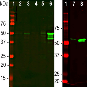 Glial Fibrillary Acidic Protein (GFAP) Antibody