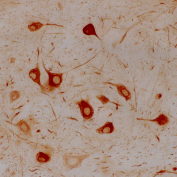 α-Internexin/NF 66 Antibody