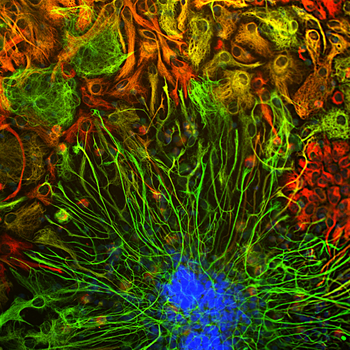 Vimentin Antibody