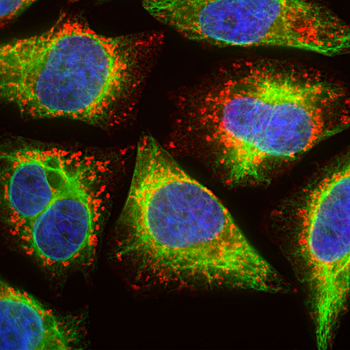 Lysosomal Associated Membrane Protein 1 (LAMP1) Antibody