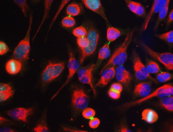 Aurora B kinase Antibody