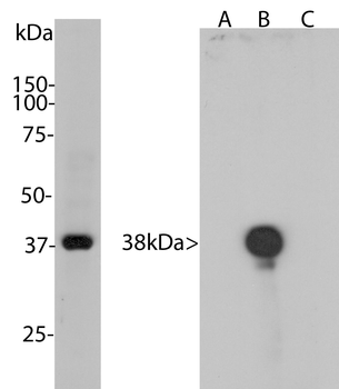 Aurora B kinase Antibody